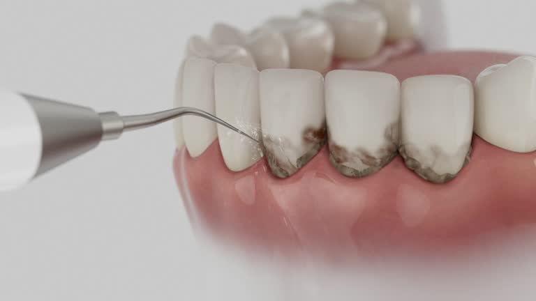 Reliable Tooth Extraction contractor in Talpa, NM by Smile Center Dentistry